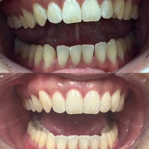 Emergency Dentistry