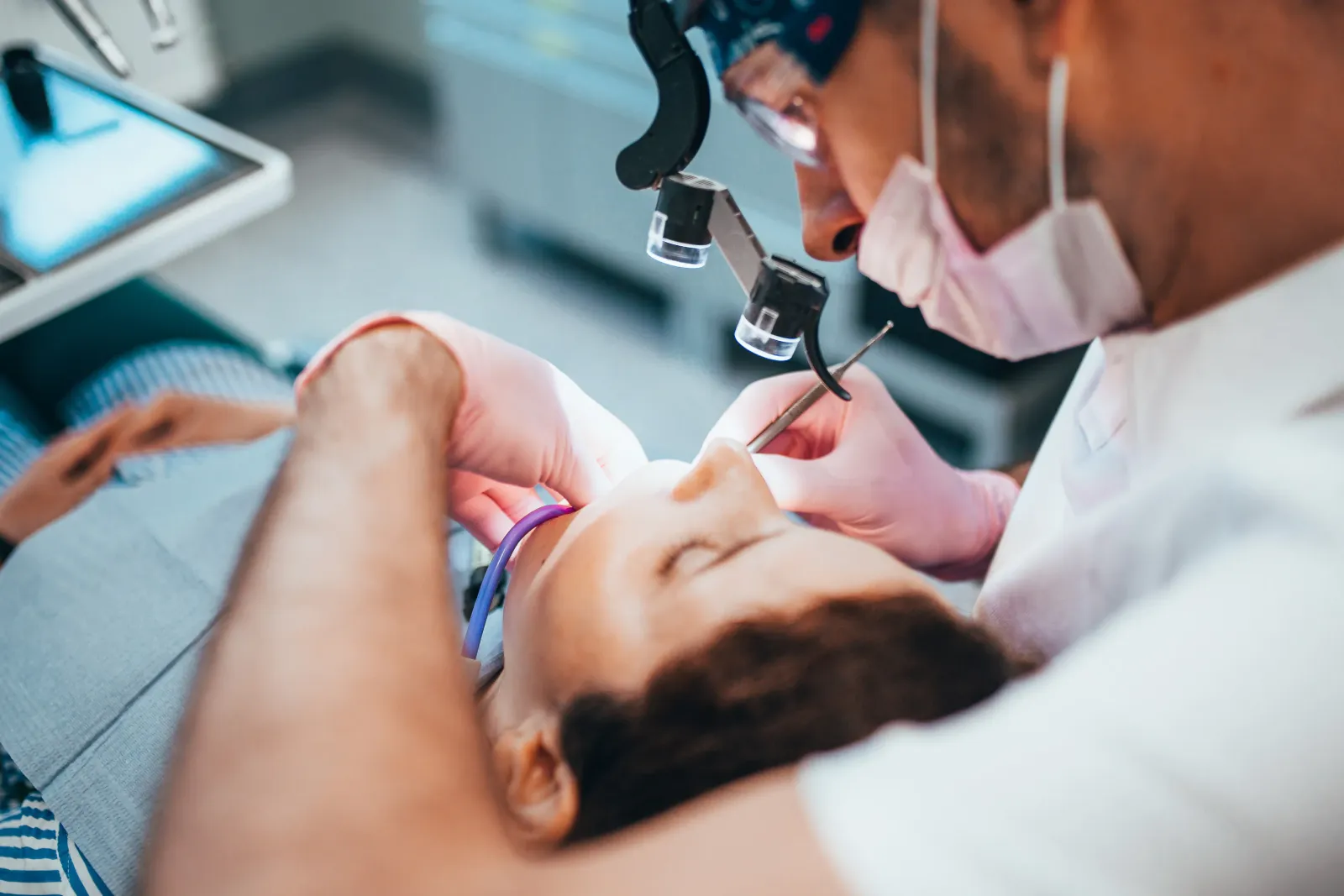Tooth Extractions