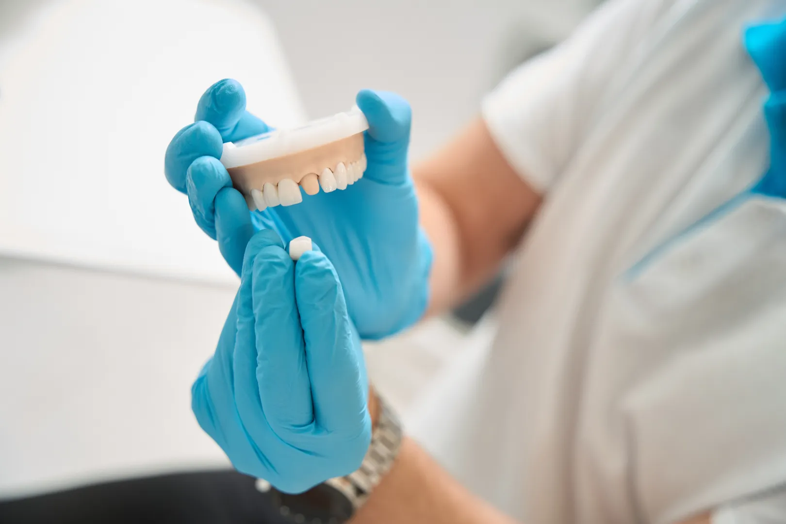 Dental Crowns