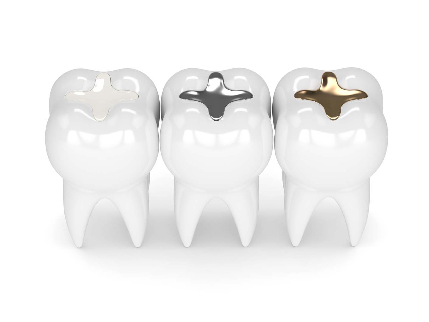 Dentures at Tampa Dental Studio