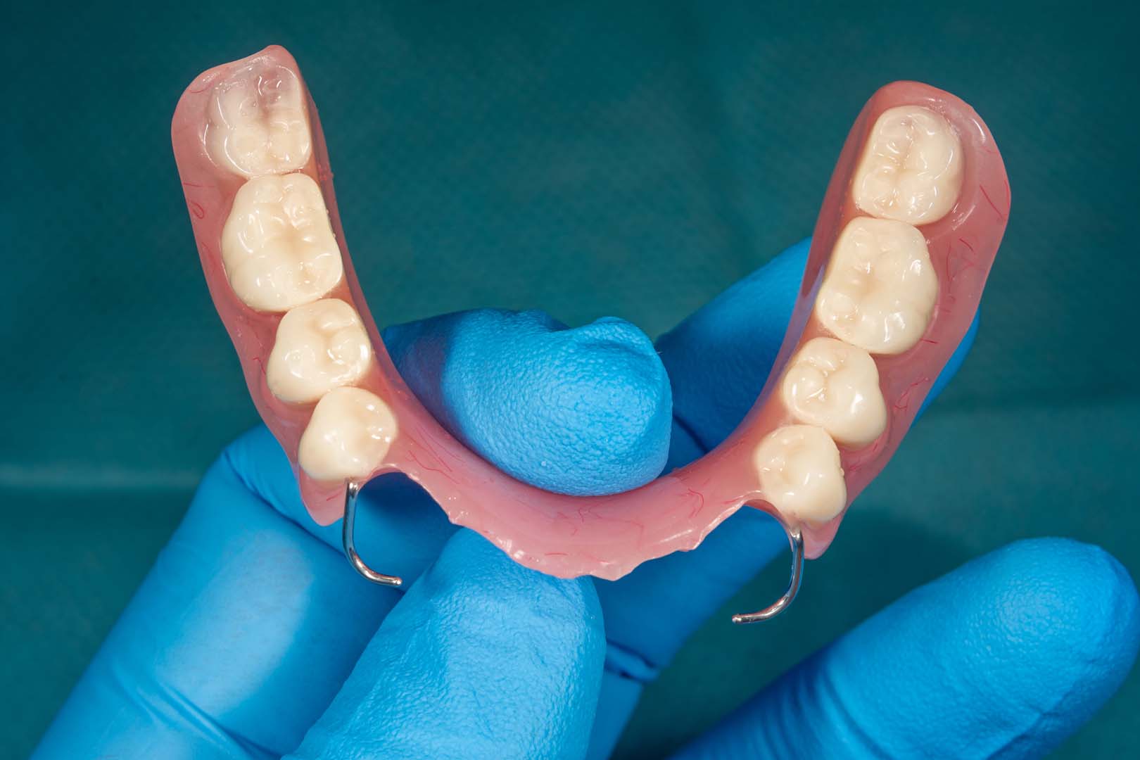 Dental implants at Tampa Dental Studio
