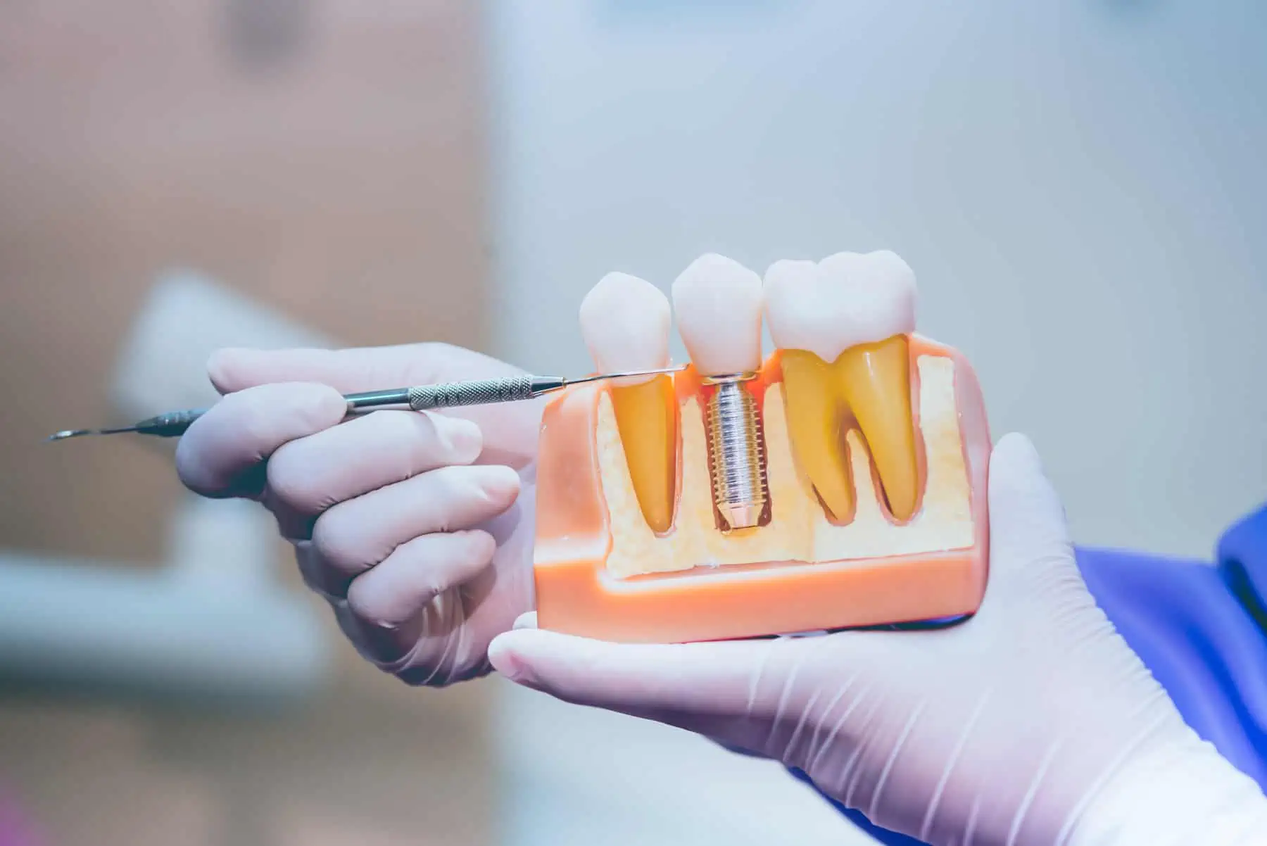Restorative dentistry at Tampa Dental Studio