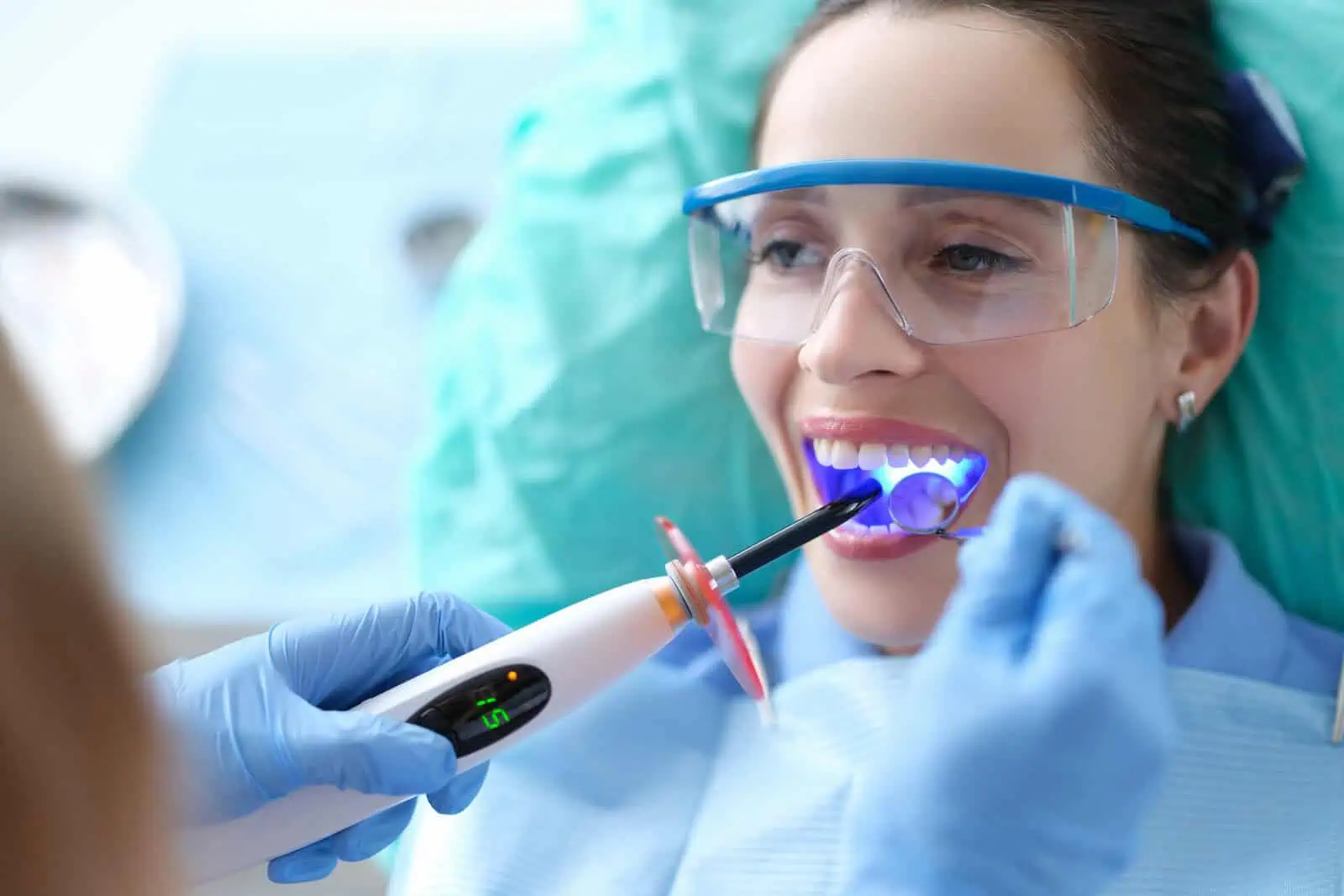 Tooth-colored dental filling restoration at Tampa Dental Studio